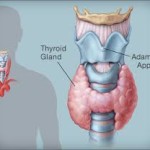 375x321_thyroid