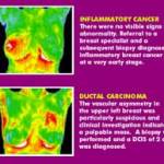 breastscan_link