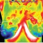 thermogram1-300x203